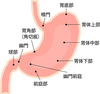 治療について 胃がん | 医療法人社団秀峰会 川村病院